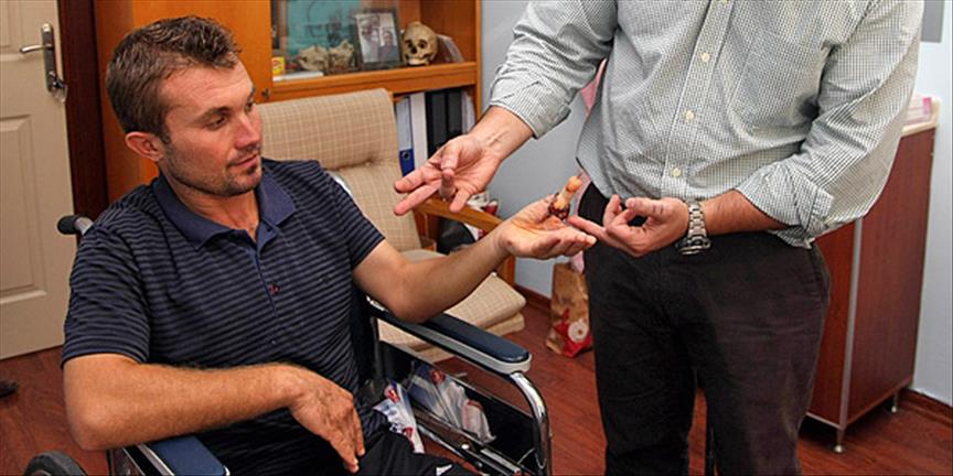 Ayak parmağı sol elinde