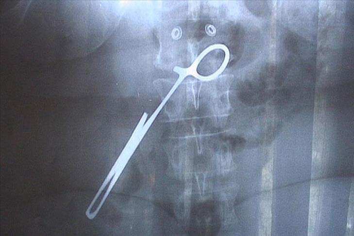 Tıbbi hatalara karşı korunma rehberi 