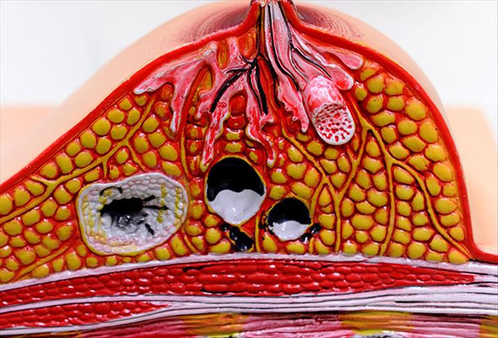 Meme kanserinde risk faktörleri 