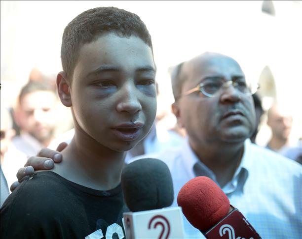US teen says did not throw stones, was brutally attacked