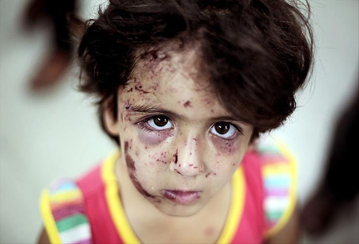 370 binden fazla çocuğun 'psiko-sosyal' yardıma ihtiyacı var