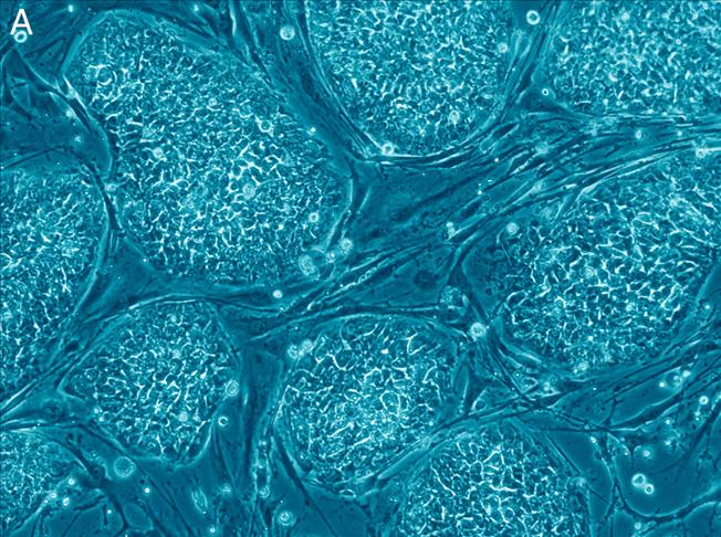 Japan researchers use stem cells in bid to restore eyesight