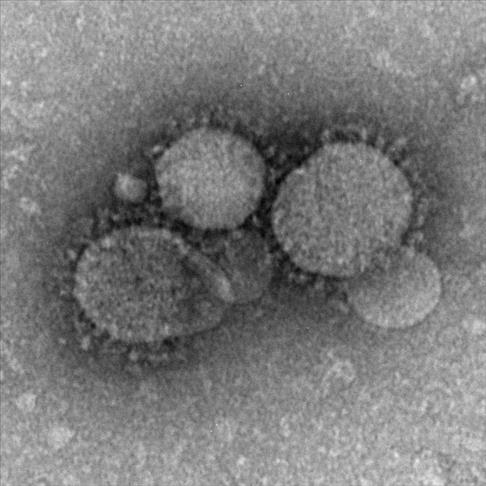 2 Indonesian pilgrims reportedly infected with MERS