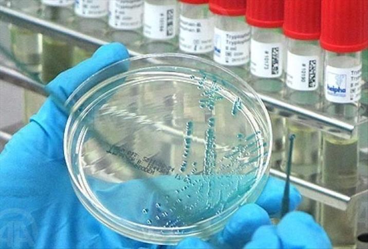 Egyptian woman dies of bird flu