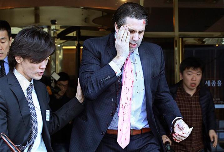 US envoy attacker faces attempted murder charge