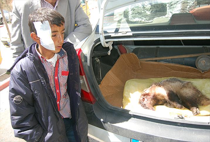 Eve giren porsuk uyuyan çocuğa saldırdı