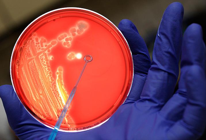 ABD ordusu yanlışlıkla canlı şarbon bakterisi göndermiş