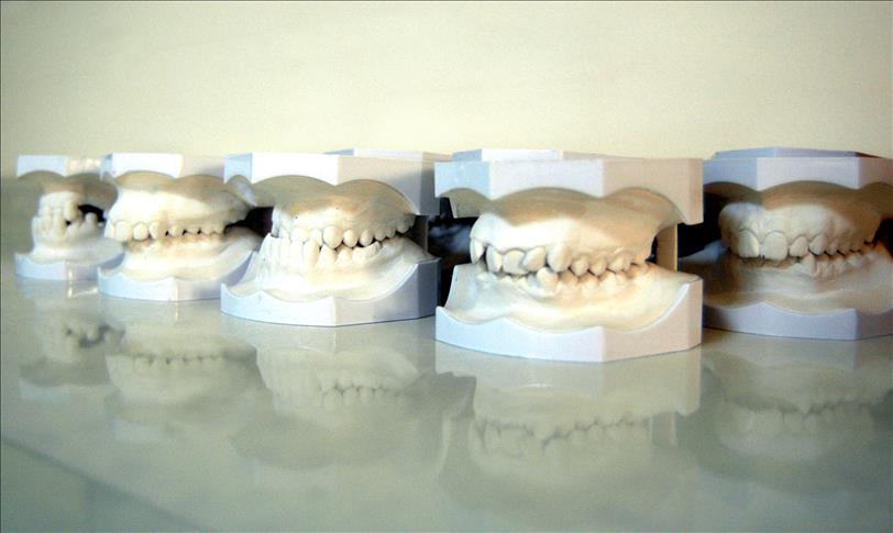 Non-smoking Ethiopians seek solution to ‘smoker’s teeth’