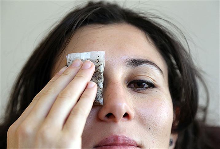 Göz pansumanı için "şekersiz çay"