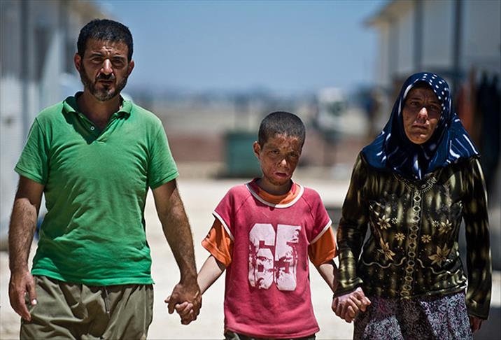 Yüzü yanan Suriyeli çocuğun umudu Türk doktorlar