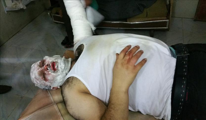 Gazetari i AA plagoset në një sulm me raketa në Siri