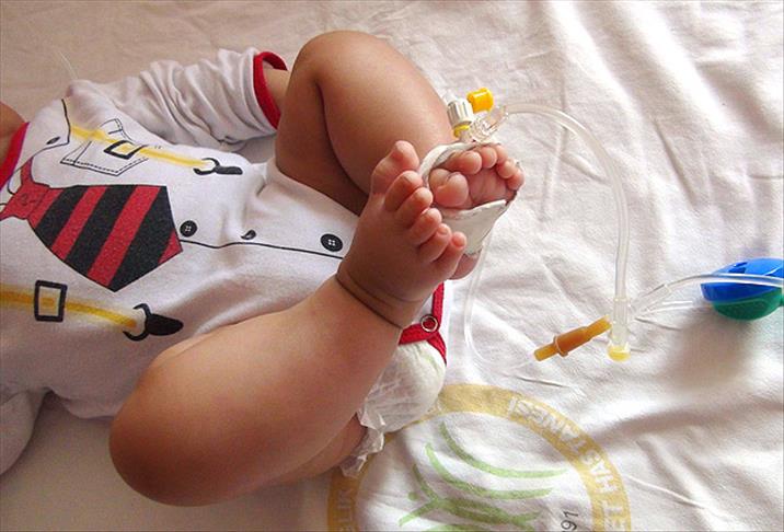 Kızıltepe'de 24 parmaklı bebek görenleri şaşırttı