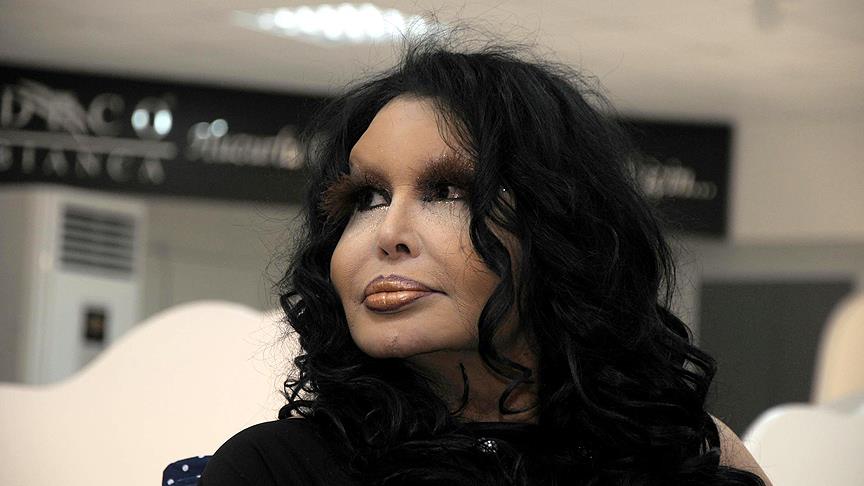 Bülent Ersoy domuz gribi şüphesiyle tedavi altında