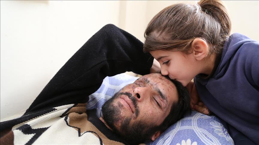 Сирийская дочь: "Я прошу докторов отдать мои глаза папе"