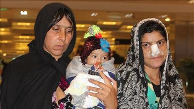 Burnu kesilen Afgan kadın tedavi için Türkiye'de