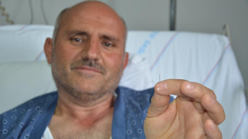 Akciğerinden 'dikiş iğnesi' çıktı