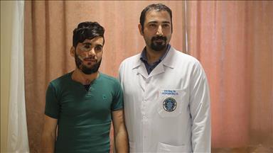 Kendi dokusundan yapılan yüzle hayata döndü