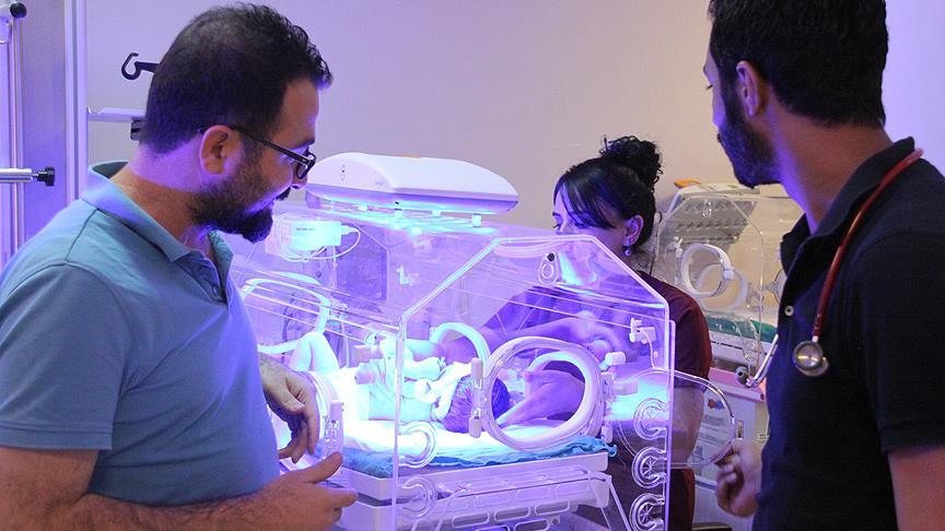 Siirt'te 'yılan bebek' dünyaya geldi