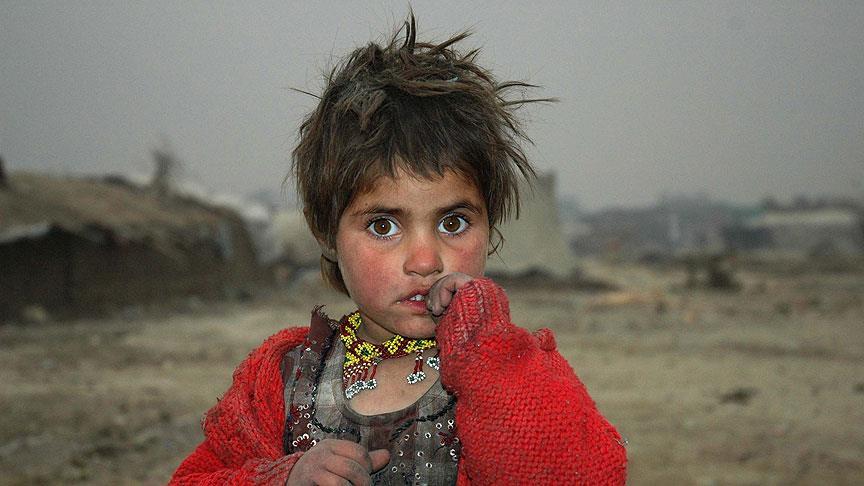 Afganistan Da Kalbi Delik 11 Bin Cocuk Tedavi Olmayi Bekliyor