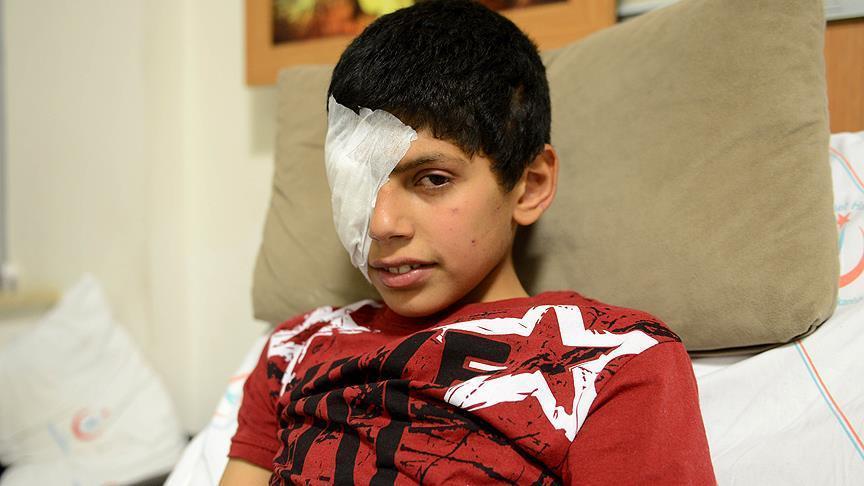 Маленький сириец потерял глаз в результате взрыва мины 