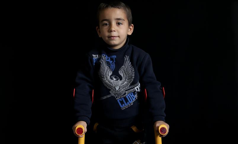 أجساد الأطفال السوريين تحكي مأساة حرب سلبت طفولتهم
