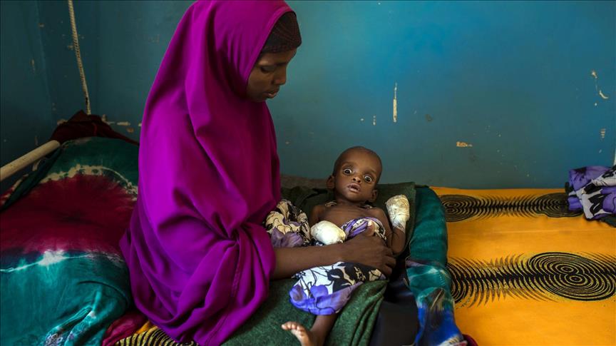 1.4M children in Somalia acutely-malnourished: UN body