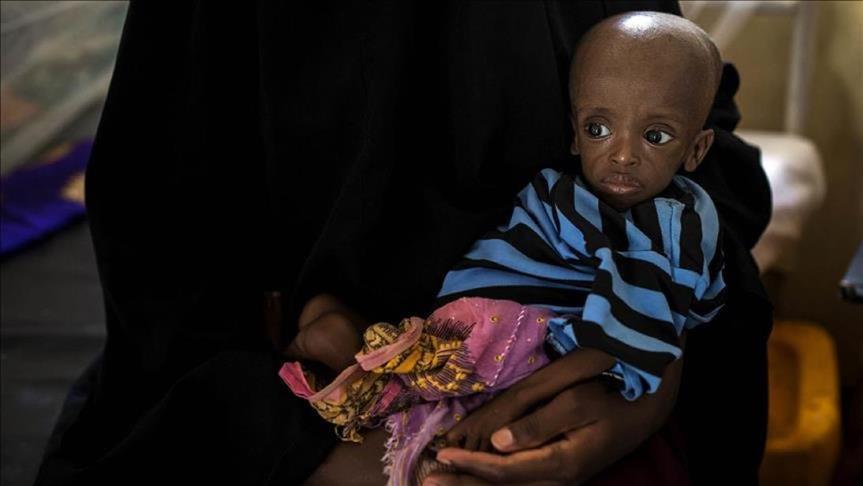 Les enfants Somaliens entre la vie et la mort