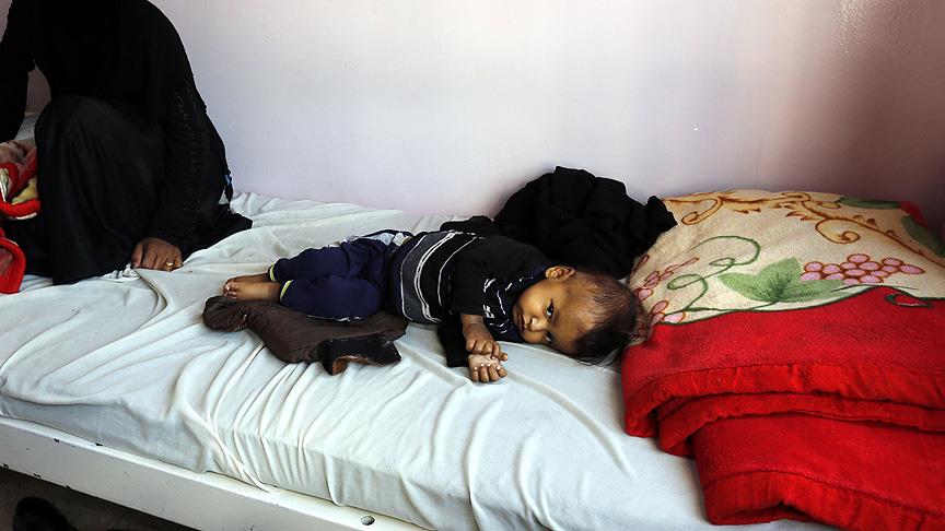 Yemen'deki kolera salgınının bilançosu ağırlaşıyor