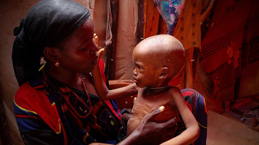 Dünya Sağlık Örgütü: Somali'de milyonlarca kişi kıtlığın eşiğinde
