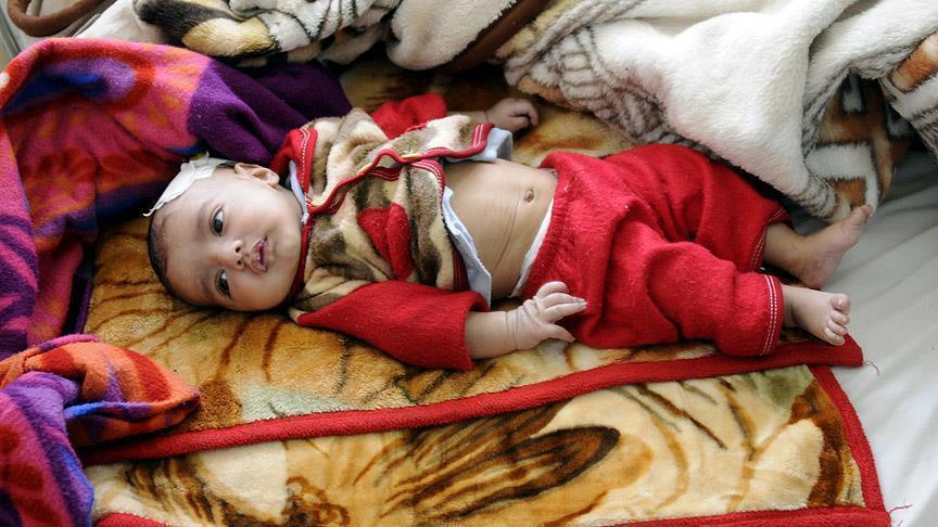 ONU : Le Yémen est au bord de la famine 