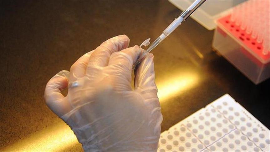 Científicos de EEUU, cerca de trasplantar órganos de cerdo a humano