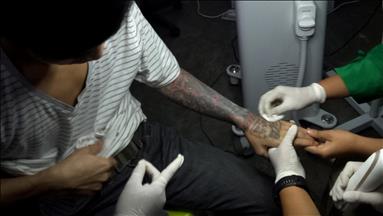 Punk muslim bertobat, hapus tato dengan Ar-Rahman