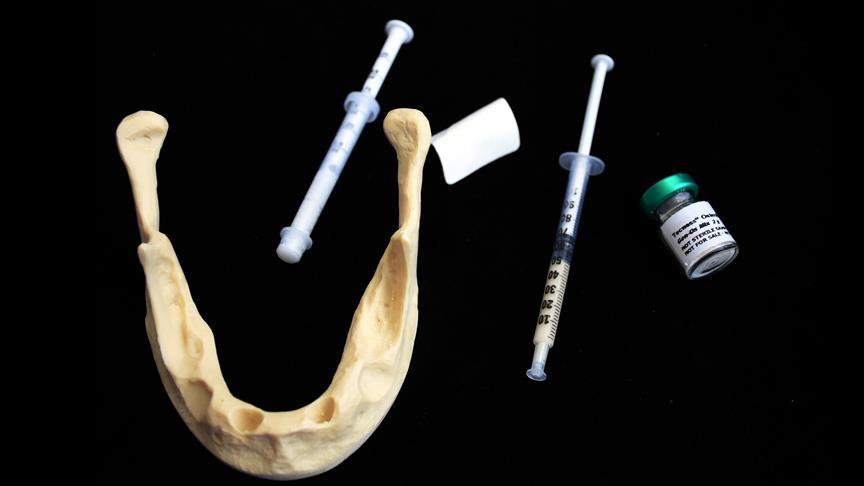 'Türkiye'de yılda 400 bin implant yapılıyor'