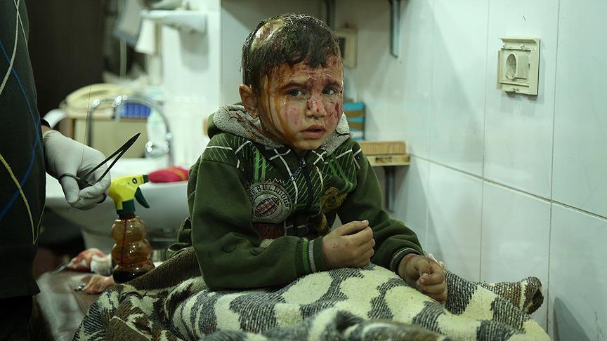 مقتل طفل وإصابة 14 مدنيا بقصف للنظام السوري على الغوطة الشرقية 