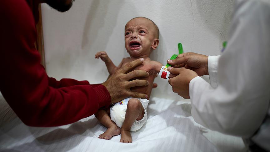 'Doğu Guta'da yetersiz beslenen çocukların sayısı ürkütücü boyutlarda'