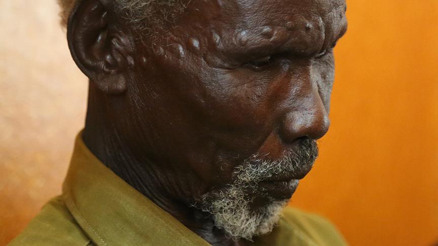 Güney Sudan'da yetişkinliğin ve gösterişin ilk şartı yüz nişanı