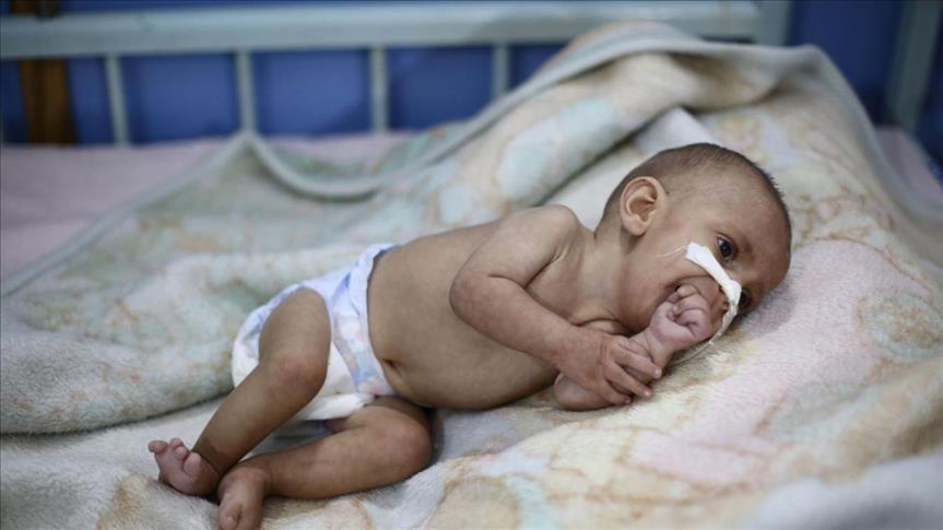 عجزت الأمم المتحدة عن إخراجه.. وفاة طفل آخر في غوطة دمشق المحاصرة