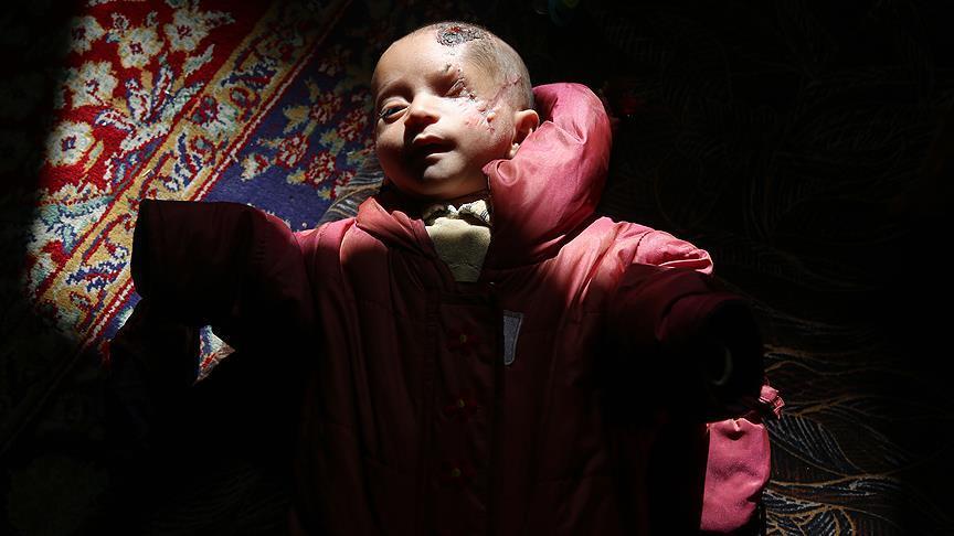کودک 2 ماهه سوری؛ زندگی با مقاومت معجزه‌آمیز