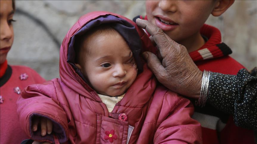 Turkish ministers show support for Syrian infant 