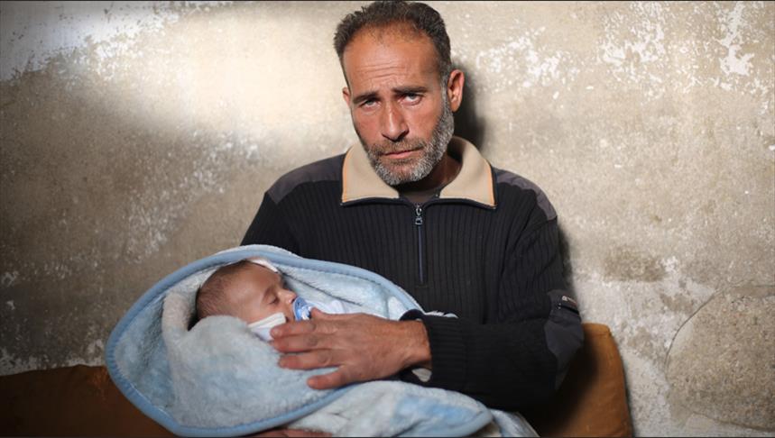 فقدان عينه وأمه ليست النهاية.. الطفل السوري "كريم" يواجه ما هو أسوأ