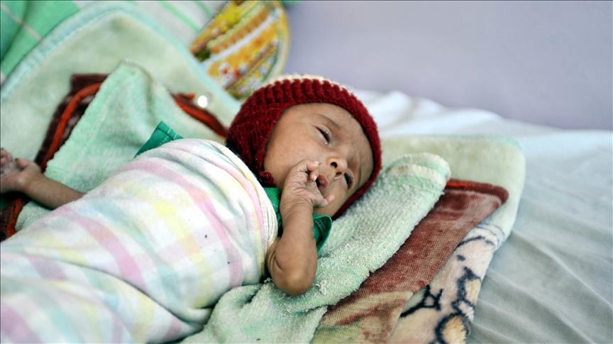 Indonesia: 61 children die of measles, malnutrition