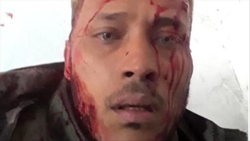 Venezuela: Exigen informes forenses para aclarar caso de Óscar Pérez