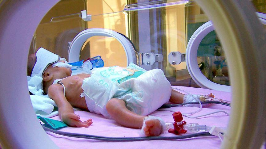 Svakodnevno širom svijeta premine 7.000 novorođenčadi