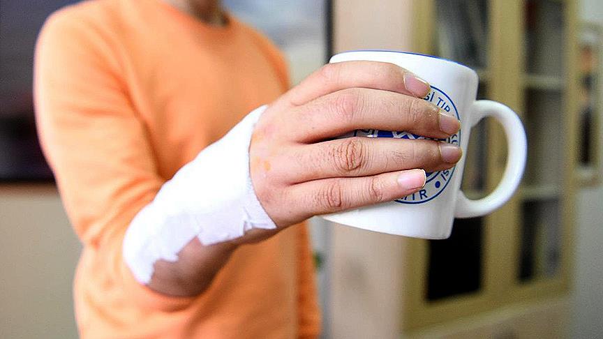 Ege Üniversitesi'nde el bileği protezi geliştirildi 