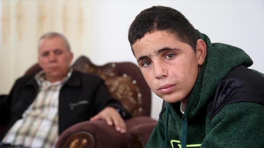 Injured Palestine teen recalls detention, interrogation