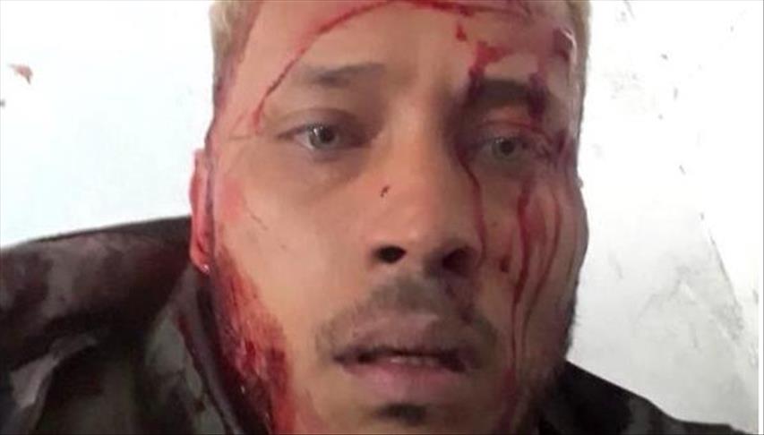 Venezuela: califican muerte de Óscar Pérez de ejecución extrajudicial