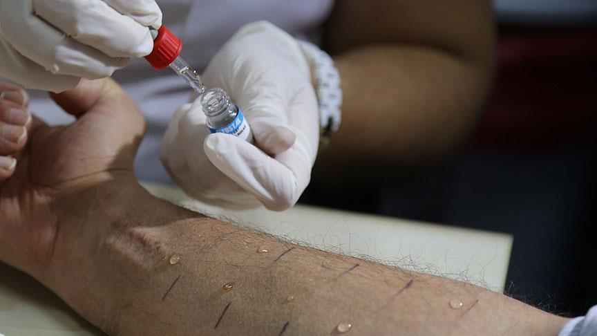 الاشتباه في إصابة 619 حالة بـ الجرب في مدارس مكة المكرمة