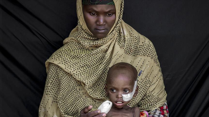 Nigerija: Oko 88 hiljada djece životno ugroženo zbog neuhranjenosti