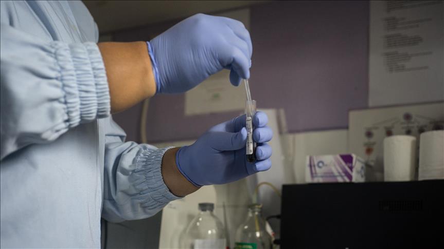 En el mundo 1,8 millones de personas contrajeron VIH en 2017