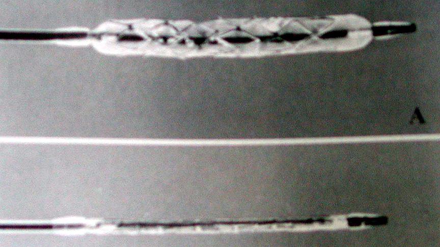 Koroner kalp hastalığına mikro stent geliştirildi